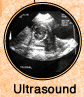 Ultrasound