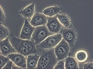 HeLa cancer cells