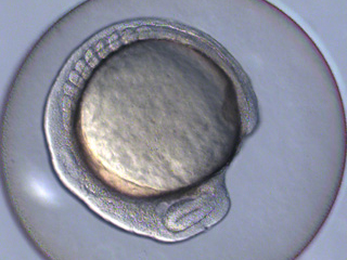 Zebrafish Development Video still #6