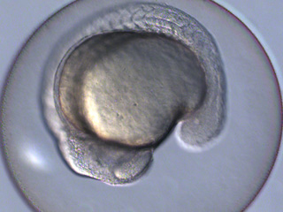 Zebrafish Development Video still #7