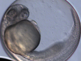 Zebrafish Development Video still #8